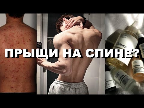 Как избавиться от прыщей на спине?// Уход за кожей тела