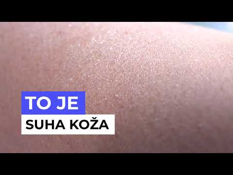Video: Kako Narediti Kožo