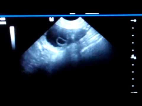 Узи собак сроки. Как выглядят щенки на узи. Узи собак сроки. День узи. Узи собаки на беременность.