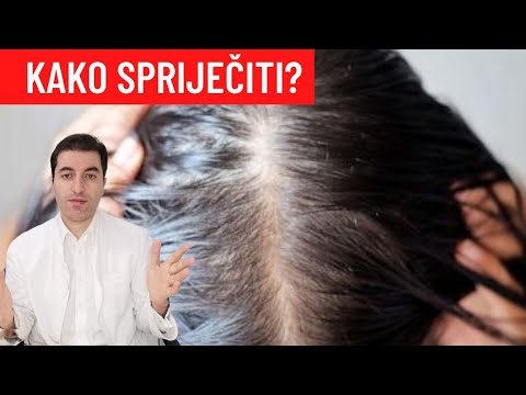 Video: Akupunktura Za Gubitak Kose: Je Li Učinkovita?