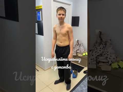 #сколиоз #дети #правка