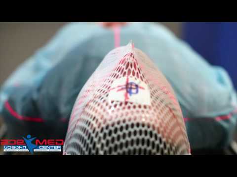 სხივური თერაპია