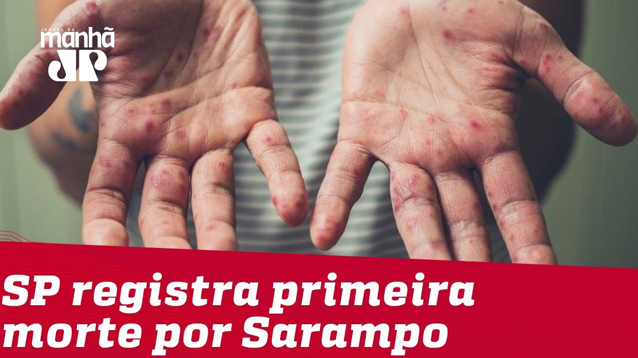 josias de souza gazeta SP registra primeira morte por sarampo