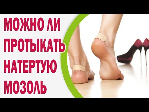 Можно ли протыкать натертую мозоль