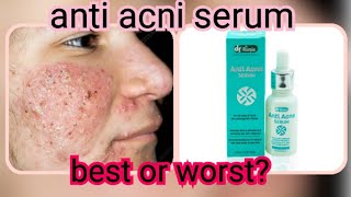 Dr Romia products review /best anti acni serum#viral #youtube #beautyhacks #viral