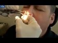 This Guy Thought There Was Something Wrong With His Nose. What The Doctor Pulls Out? 