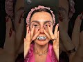 Il Punto Dell’Acne Ti Dirà Tutto!🤯