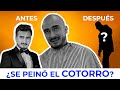 Ricardo prez de la cotorrisa  injerto de cabello en clnica dreo con el dr enrique orozco