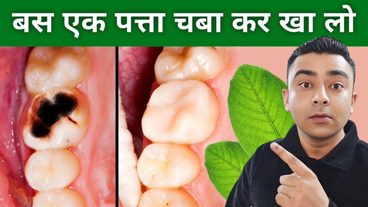 दांतों को सड़ने से बचाएगा ये 1 जादुई पत्ता | खाने के बाद जरूर चबाएं | Teeth Cavity Remedy