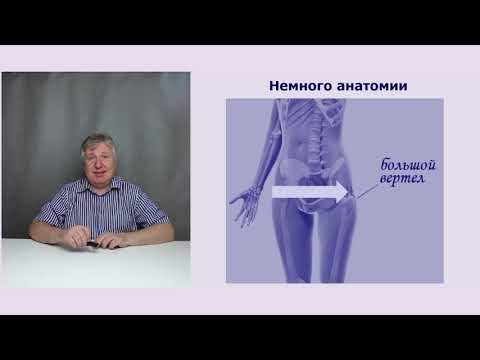 Вопрос: Как лечить фибромиалгию?