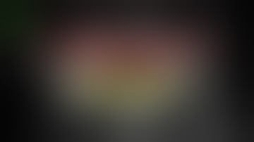 Laparoscopic left lateral sectionectomy