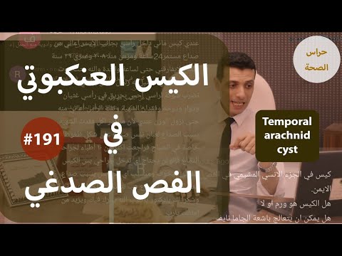 فيديو: هل الخراجات العنكبوتية تتطلب جراحة؟