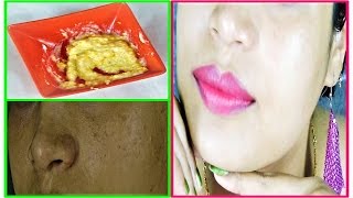 Home Remedy For Easy Remove Blemishes Pigmentation Acne Spots & Freckles/get FLAWLESS skin in Hindi