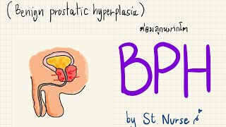 BPH : ต่อมลูกหมากโต ; จุดเน้นออกสอบ #การพยาบาล #สอบสภา #ข้อสอบสภาการพยาบาล