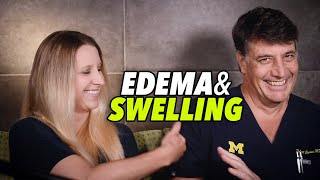 UNDERSTANDING EDEMA AND SWELLING