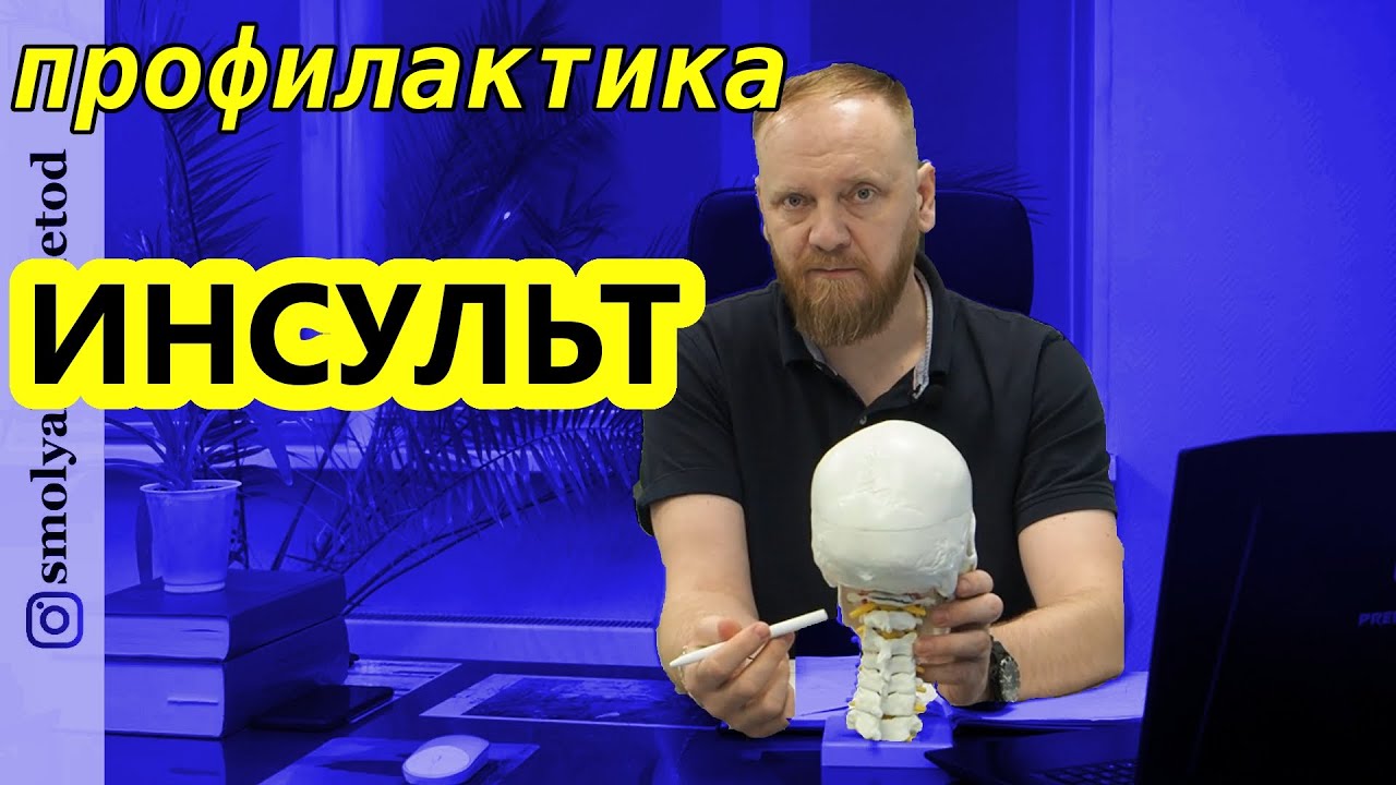 профилактика ИНСУЛЬТА. Как избежать инсульт. Простые советы для восстановления кровоснабжения головы