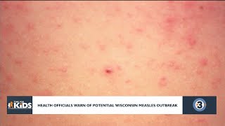 Taking a look at measles vaccination rates in Wisconsin in light of recent Texas measles death Measles Vaccination Rates