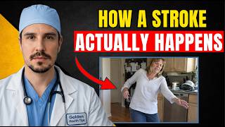 5 Silent Stroke Signs That Happen Days Before It Hits