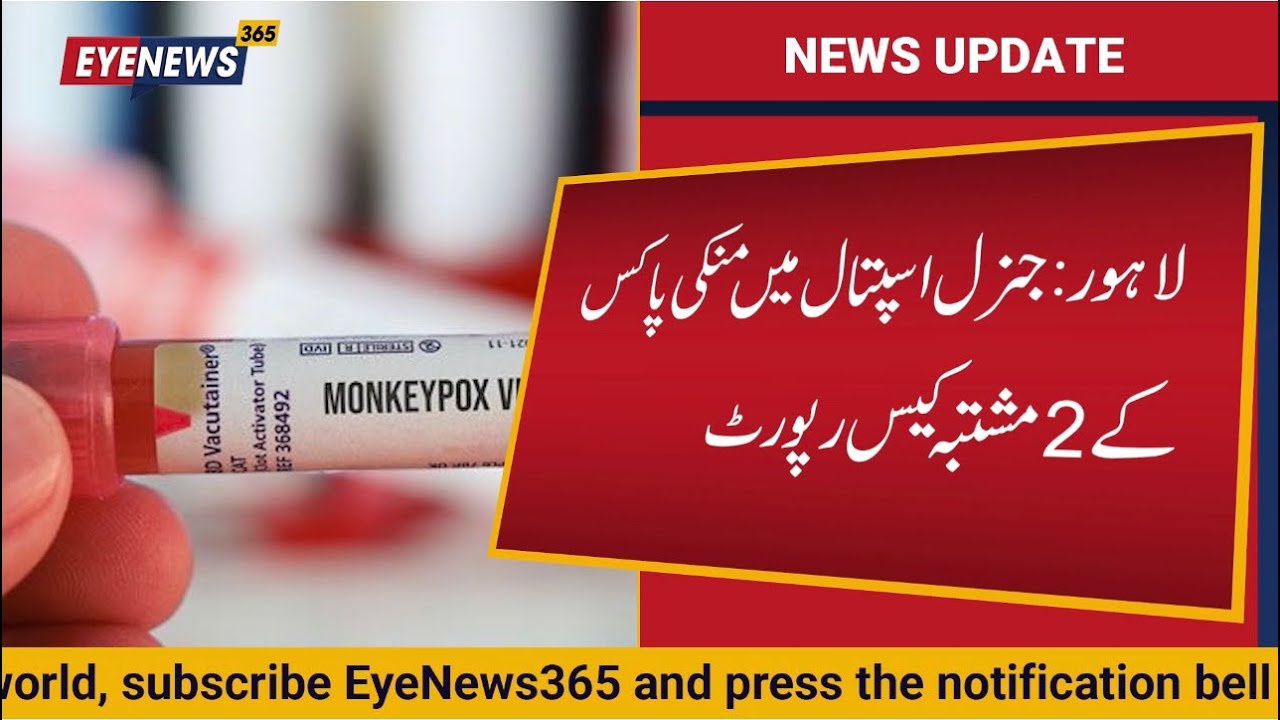 Two suspected cases of monkeypox reported in Lahore