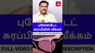 ப்ராஸ்டேட் சுரப்பி வீக்கம் | Swollen Prostate Treatment for prostate enlargement #shorts