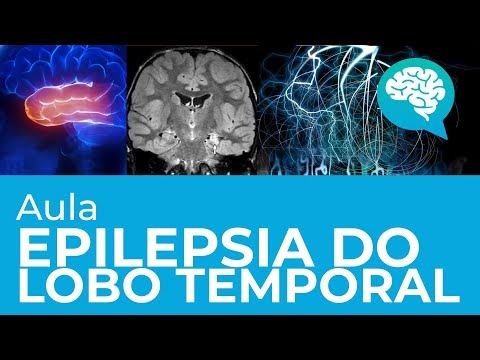 Vídeo: Tumor Neuronal-glial Misto No Lobo Temporal De Uma Criança: Relato De Caso