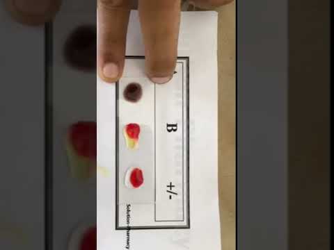 تعیین گروپ خون خیلی سریع و اسان Blood Group Type