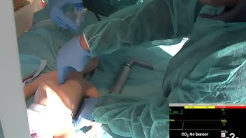 Simulazione in Neonatologia - SimNewB