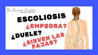 ¿Cómo se trata la escoliosis? ¿Qué tipo de ejercicios puedo hacer?