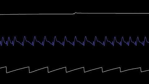 COMMODORE C64 SID 2020 - DER KOMMISSAR - CHRIS-DO / Oscilloscope View / Chiptune