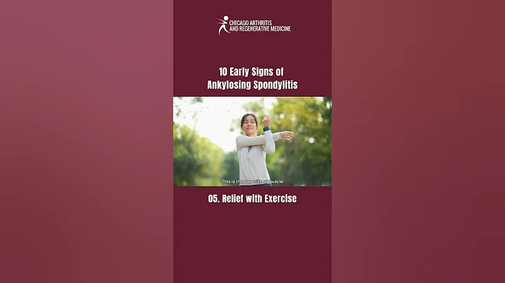 Relief with exercise | 10 Early Signs of Ankylosing Spondylitis You Shouldn’t Ignore!