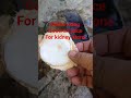 coconut juice for flushing kidney stone #songviral #coconutwater