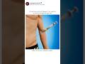Do you know what will happen if an Injection is injected wrongly through Vein #trending #pharmcist
