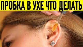 ПРОБКА В УХЕ ЧТО ДЕЛАТЬ | Как понять что у вас пробка в ухе