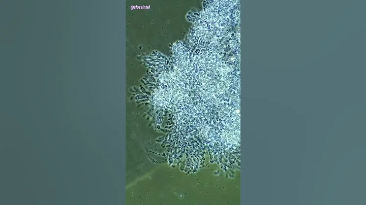 Bleach vs Germs Under Microscope (Cell Melts Away)