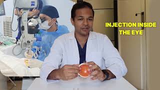 Blurry Vision? Might NOT Be Cataract | Macular Degeneration (AMD) & Intravitreal Injection Explained