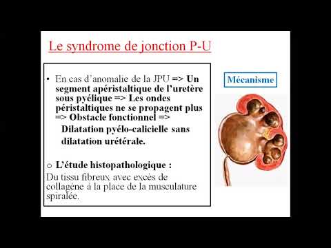 Vidéo: Joint de dilatation à soufflet : classification et fonction de l'appareil