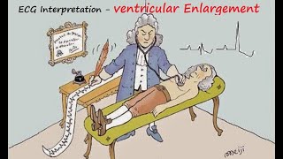 Ecg Interpretation - Ventricular Enlargement Part-Xb