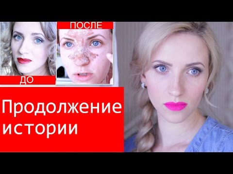 КОНЕЦ ИСТОРИИ или КАК ВЫБРАТЬ КОСМЕТОЛОГА КОНЕЦ ИСТОРИИ или КАК ВЫБРАТЬ КОСМЕТОЛОГА