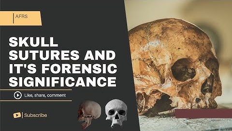 Skull Sutures and it