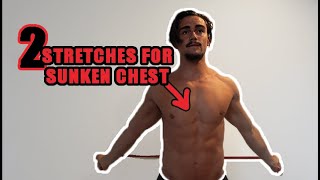 2 Stretches to Minimise your Sunken Chest