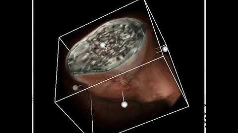 VR -Volume Rendering-