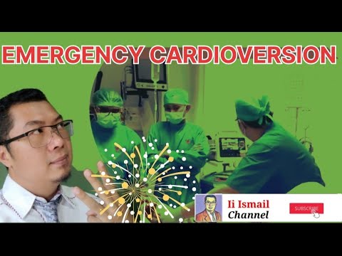 Video: Adakah anda mengalami masalah kardiovert?