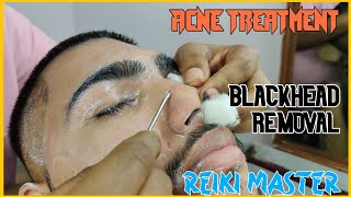 REIKI MASTER?Acne Treatment and Blackheads Removal with Face Steam?MASTER ASMR?ASMR