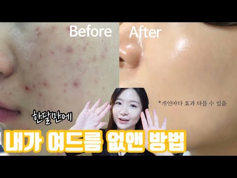 Eng Sub) How to improve your skin in a monthㅣ half VLOG