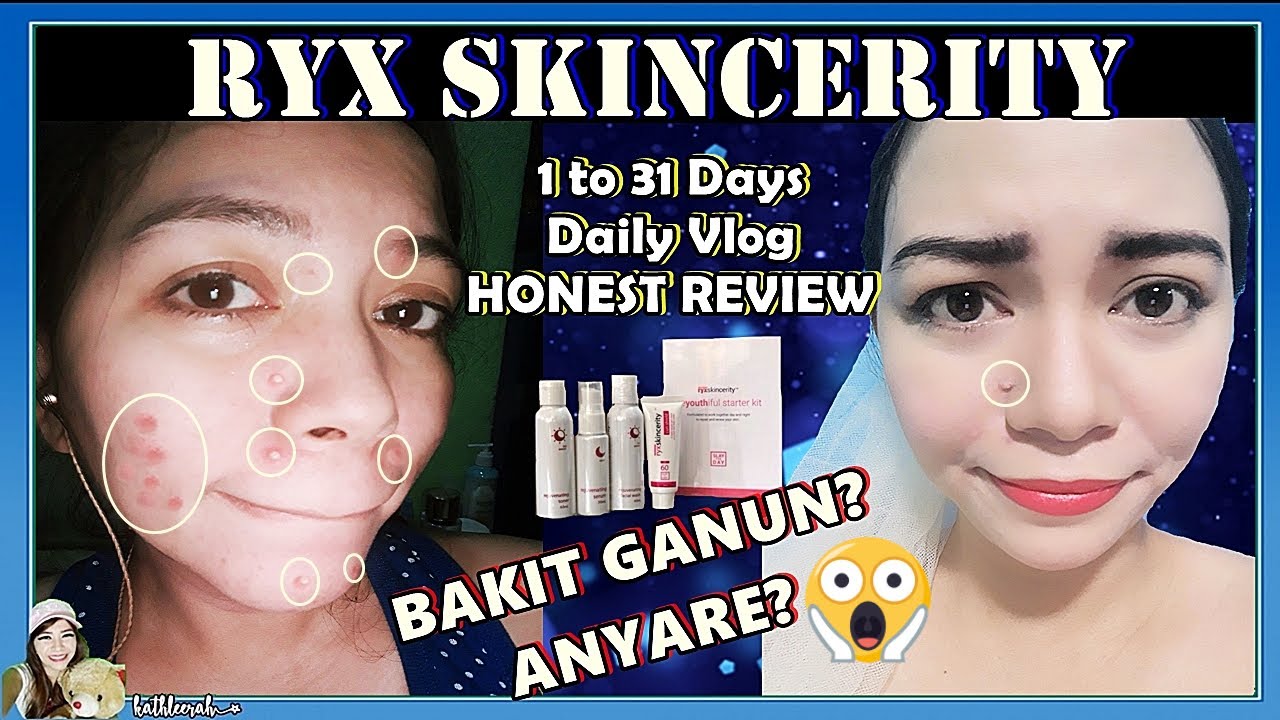 1 to 31 Days RYX SKINCERITY REJUVENATING SET Daily Vlog Honest Review ...