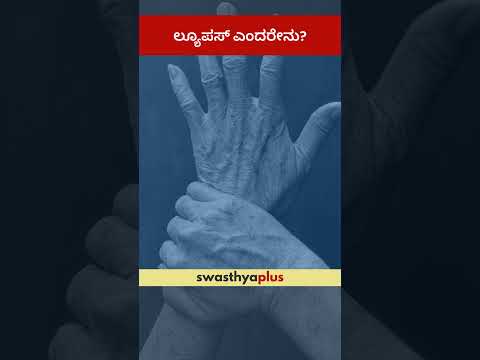 ಲ್ಯೂಪಸ್ ಎಂದರೇನು? | What is Lupus? | Dr Arun M S | #Shorts
