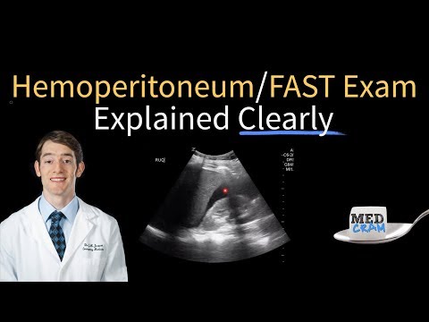 Video: Hemoperitoneum: Behandling, Komplikationer, Symptomer Og Mere