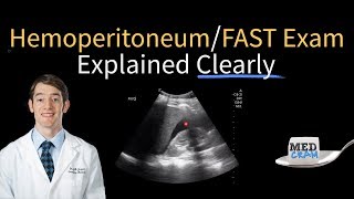 Hemoperitoneum / Free Fluid in the RUQ on Ultrasound  FAST Exam