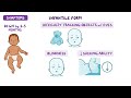 Canavan disease (Year of the Zebra)