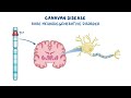 Canavan disease (Year of the Zebra)
